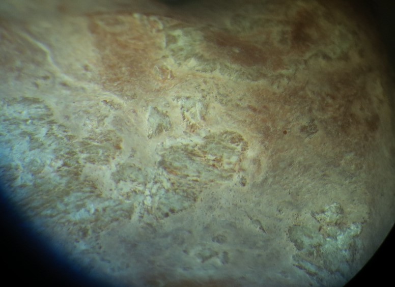 Magnified zoomorphic surface.