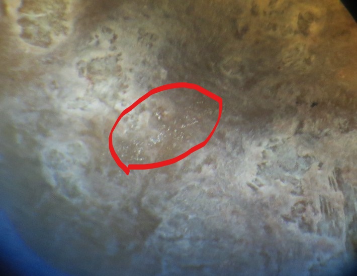 Metallic granules on the zoomorphic in a red circle with raised relief on the right.